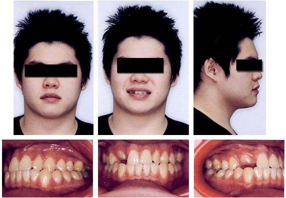 Figure 11 Pre-treatment facial and