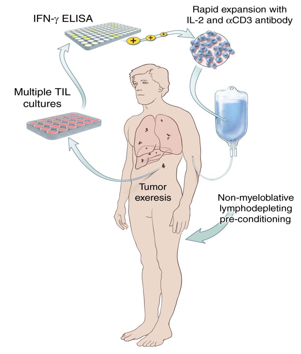 Adoptive T cell therapy of NCI Gattinoni L.
