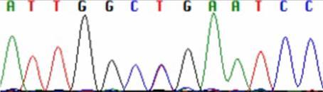 ips cells retain SCN1A mutation Ile Gly Arg Ile Control ips p.