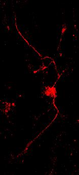 Few Glutamatergic Neurons