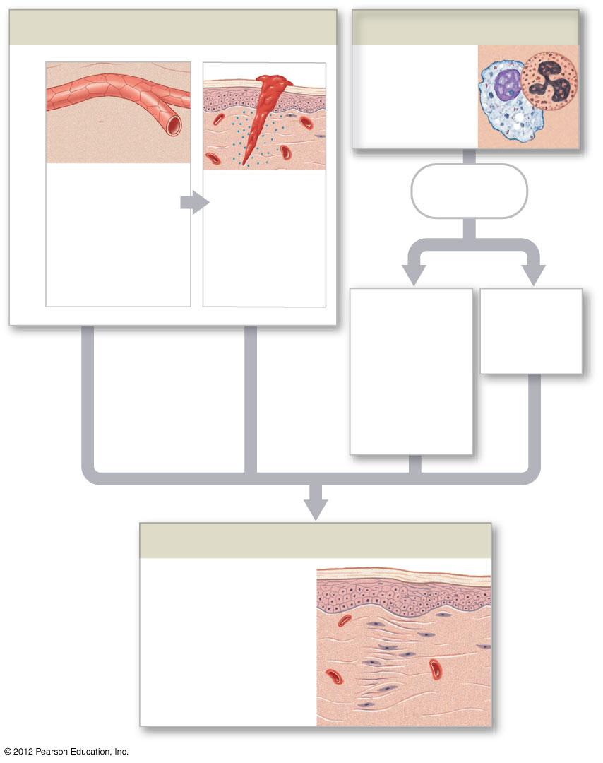Figure 22-15 Inflamma5on and the Steps in Tissue Repair (Part 2 of 2) Redness, Swelling, Warmth, and Pain Phagocyte AVrac6on AVrac6on of phagocytes, especially neutrophils Dila6on of blood vessels,