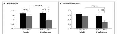 Pioglitazone 45 mg/d vs. placebo for 6 months in NASH All on a hypocaloric diet Pioglitazone 45 mg/d vs. placebo for 6 months in NASH All on a hypocaloric diet Belfort R et al.