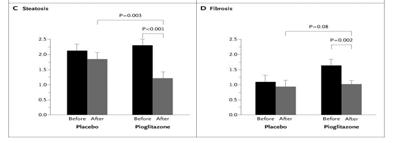N Engl J Med 2006;355:2297 2307 2307 Pioglitazone 45 mg/d vs. placebo for 6 months in NASH Hepatic histology changes Pioglitazone 30 mg/d vs.
