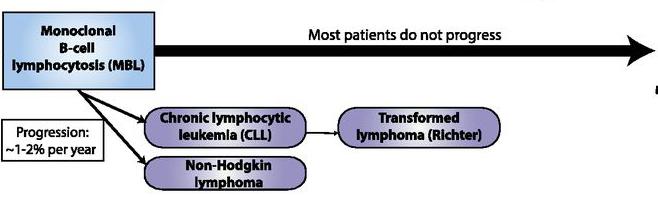 Premalignant clonal LYMPHOID proliferations Monoclonal B-cell lymphocytosis Post GC B-cell MBL Most patients do not progress - CLL-type,
