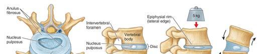 Lumbar vertebrae (Isolated and