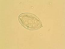 Quality Control and Information Participating and referee laboratories agreed that Schistosoma haematobium was the correct response (99 and 100%).