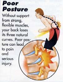 Slipped Disc - is actually a tear in the disc and it s contents spilling out Severely pinch the disc between two vertebra