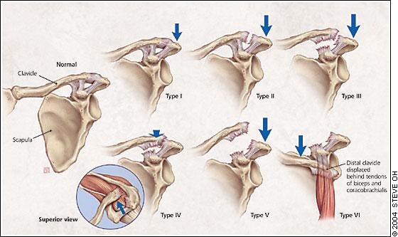 Acromioclavicular joint