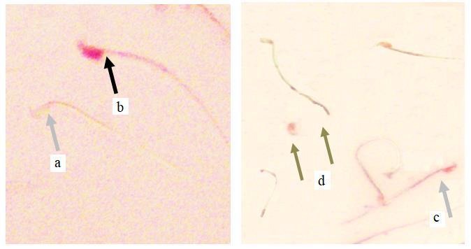 P1 with P2, and group P2 with P3. Viable and nonviable spermatozoa, as well as normal and abnormal morphology are presented in Fig. 2.