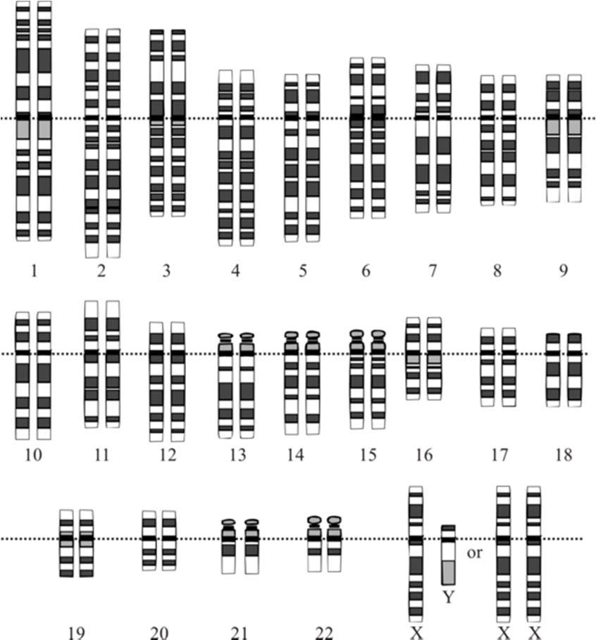 Human reference genome The human genome is the complete set of nucleic acid sequence