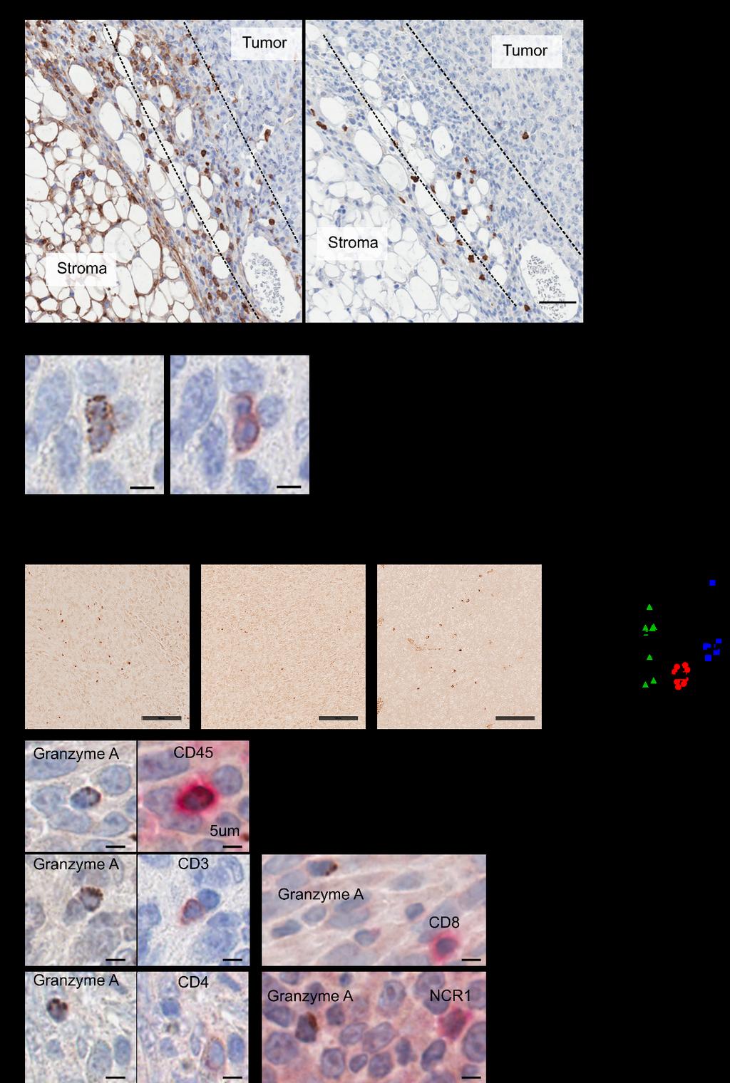 Supplemental figure 5. Immunohistochemical characterization of tumor infiltrating immune cells. A) Ly6C and Ly6G staining in serial sections of representative D2A1+ InvD6 F tumor.