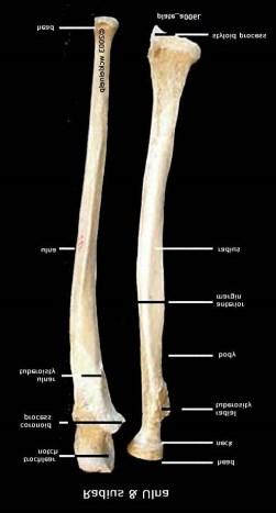 Osteology: Distal Ulna & Radius Styloid