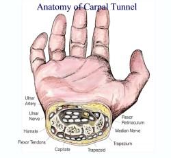 Carpal Tunnel Syndrome The Transverse Carpal Ligament Anterior muscles: Flexor carpi ulnaris Flexor carpi