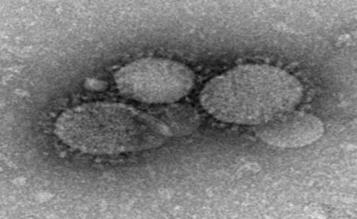 Avian influenza A(H7N9) Novel coronavirus Unusual global