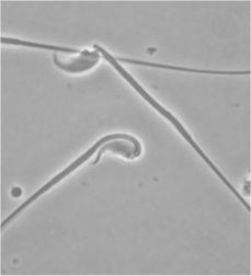 Sperm with a bent neck from a TG mouse B6;129S-Gtrosa26 Lgh DDXC-P SMXA-1 shl C3.KOR-Apoe CXDD-M STS(tremor) NOD.