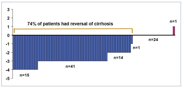 Reversion of hepatitis B cirrhosis in 74% of patients on TDF N=96 patients with cirrhosis and paired