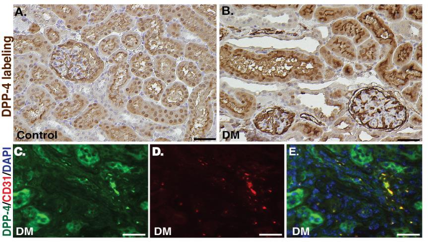 DPP-4 levels are elevated in diabetic kidney
