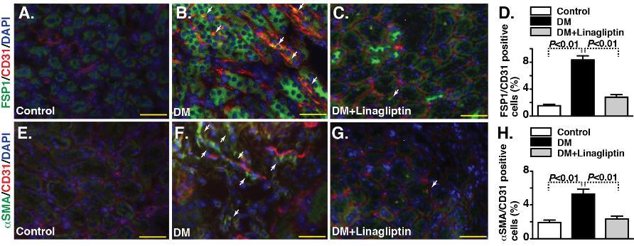 Linagliptin-suppressed kidney fibrosis in diabetic CD-1 mice was associated