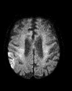stroke With enough contrasting many lesions