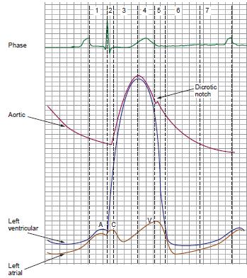 PHASES 1: Atrial Contraction 2: Isovolumic Contraction (TV/MV closure to PV/AV opening) 3: Rapid Ejection 4: Reduced Ejection (PV/AV opening to PV/AV