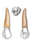 OpenStax-CNX module: m66077 14 Maxillary central incisors are larger than their mandibular counterparts.