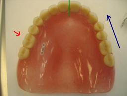 OpenStax-CNX module: m66077 7 palatal for maxillary structures.