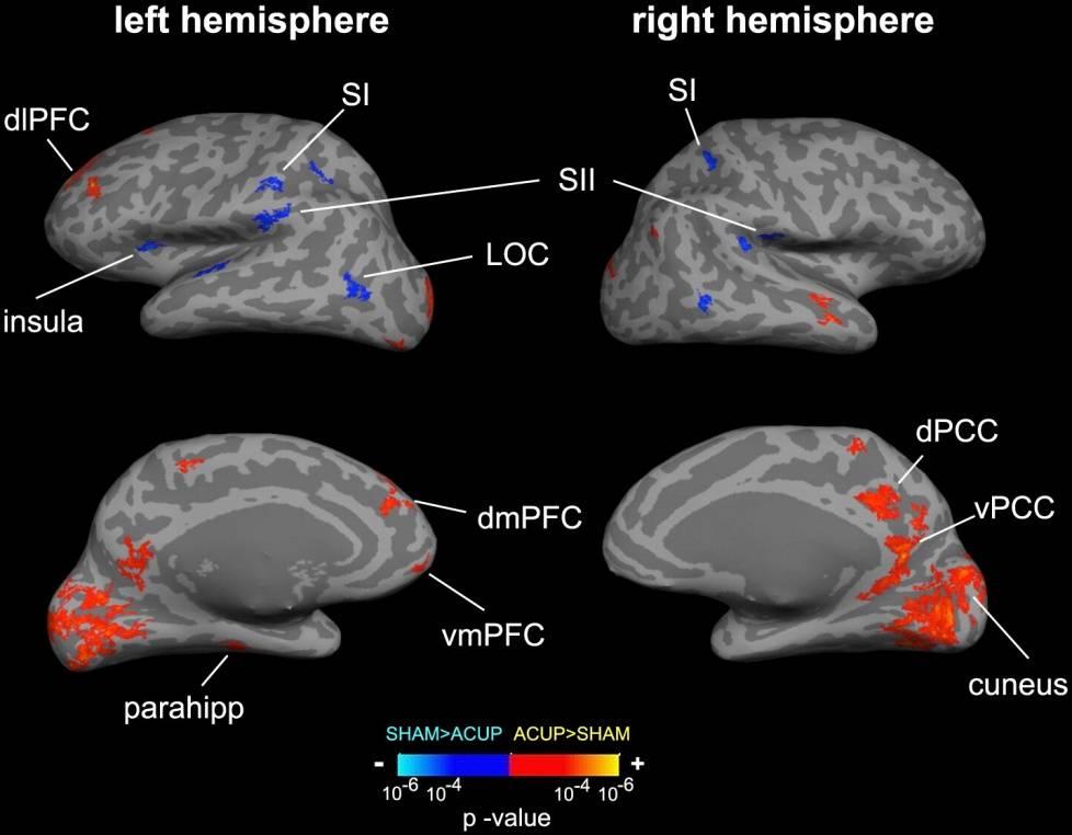 Anterior Cingulate Cortex (ACC) Integrates stimulus intensity, mood, emotion, attention & autonomic responses Strongly interconnected with other limbic structures Conscious emotional processing,