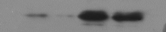 Cells were lysed and the C/EPβ expression level was determined using western blot assays.
