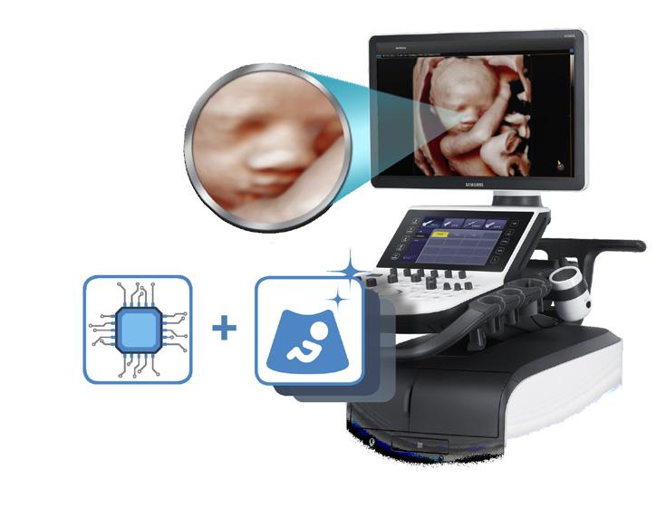 PREMIUM WOMEN S HEALTH ULTRASOUND FOR ELITE DIAGNOSIS Making a precise diagnosis on patients is absolutely critical for physicians, and WS80A with Elite is designed to