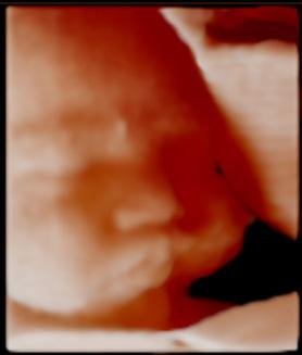 2nd trimester fetal face with