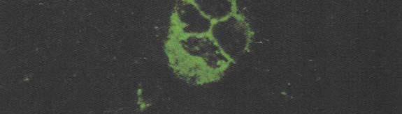 Immunofluorescent staining Cell scrape,