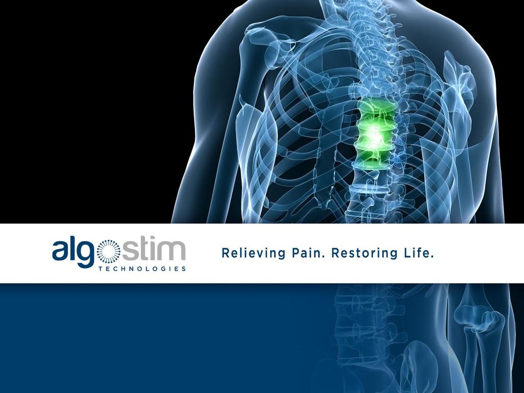 Indication: Spinal Cord Stimulation for the