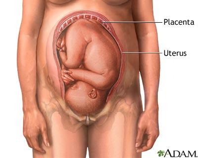 Third - pre-load the foetus in Utero!