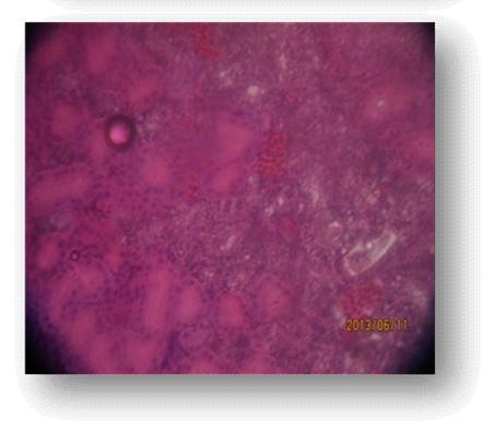 6 (10) A B C D Figure 2: Histological changes in IBD affected