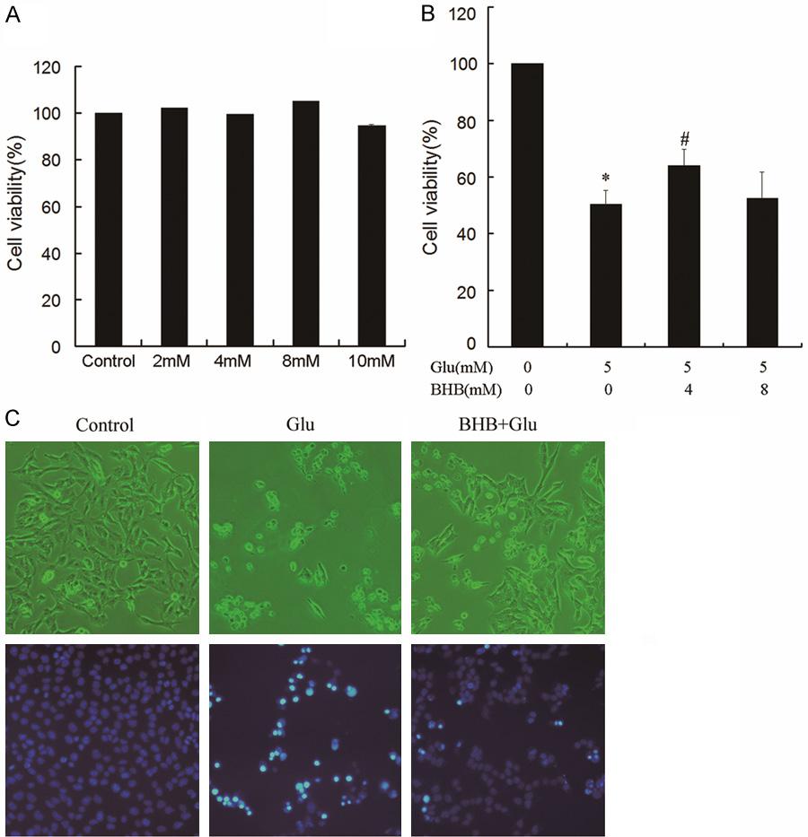 Figure 1. β-hydroxybutyrate (BHB) protects HT22 cells against glutamateinduced toxicity.