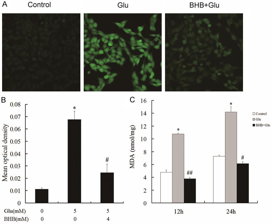 Figure 2. Effect of BHB on reactive oxygen species (ROS) production and changes in malondialdehyde (MDA) expression.