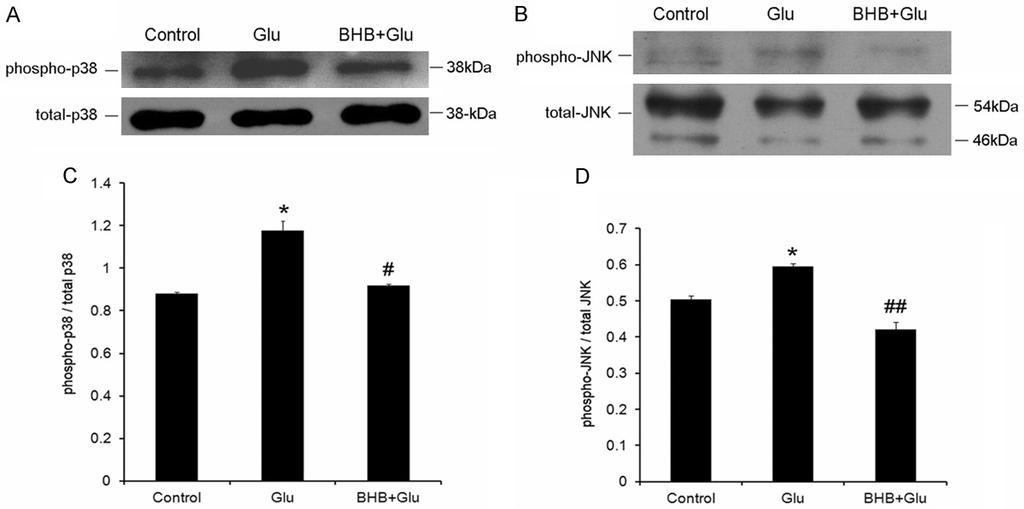 Figure 3. Representative western blot analyses of phosphorylated and total p38 and phosphorylated and total JNK expression.