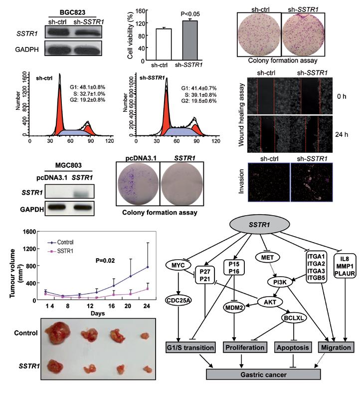 # Yu et al # (a) (b) (c) (d) (e) (f) (g) (h) (i) FIG 2. SSTR1 as a tumour suppressor in gastric cancer: (a) SSTR1 expression was knocked down by shrna transfection.