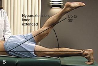 Hyperextension Seidel s Guide to