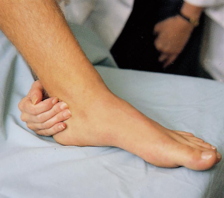 Ankle and Foot Examination Clinical Skills: