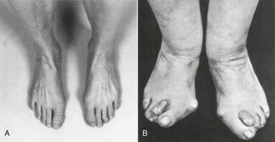 Number of Toes Orthopedic Physical