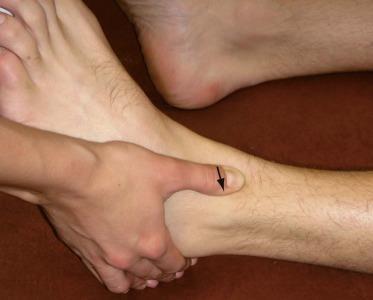 Ankle and Foot Palpation Orthopedic Physical