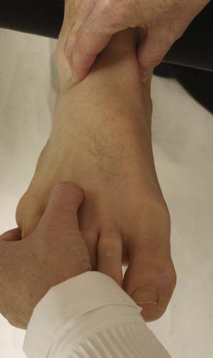 Forefoot Palpation Orthopedic Physical