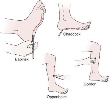 Sensation Reflexes Gate Ankle and Foot Neurovascular Neurovascular