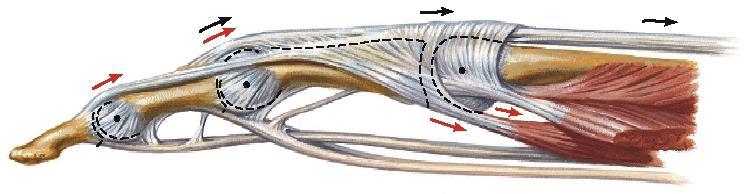 Ulnar nerve mononeuropathy C. Lower brachial plexus palsy D.