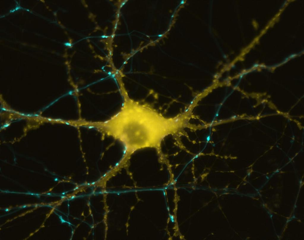 Main Parts of a Generic Neuron An axon can make