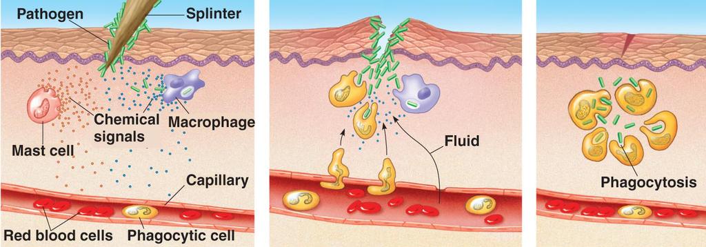 E. Inflammatory Response 1. vasodialation: blood vessels become more permeable 2. complement proteins attract phagocytes 3. macrophages consume pathogens and related debris 4.