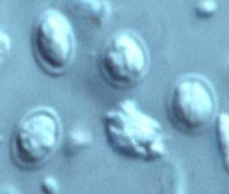 Parasite (Protozoon), cause disease called Cryptosporidiosis in humans Most common
