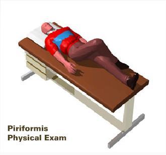 Piriformis Syndrome Pain in the posterior sciatic notch Posterior Can be elicited by deep tenderness to palpation in the region Patient lays supine with knee and hip slightly flexed and
