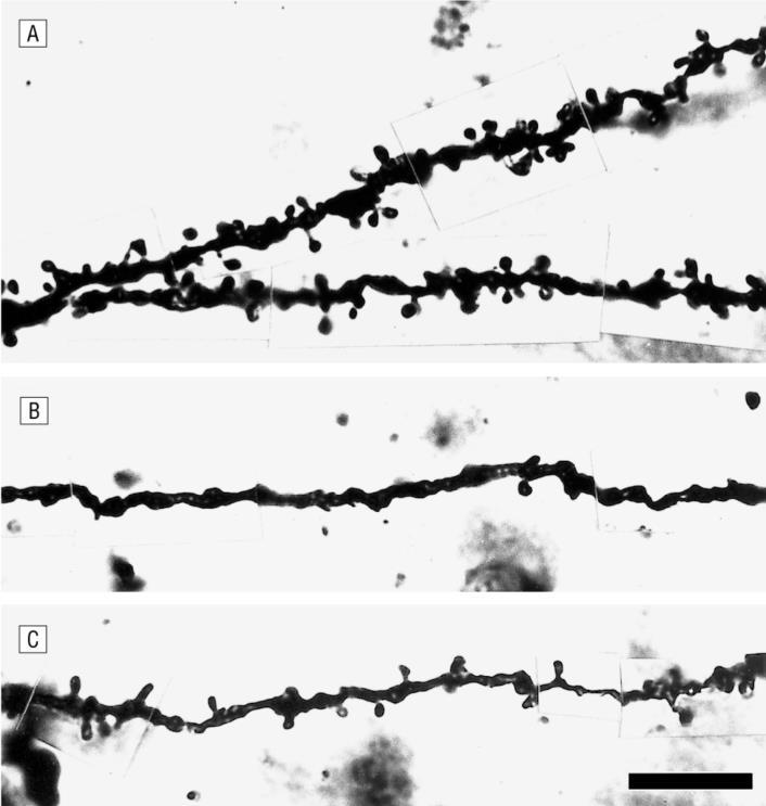 From: Decreased Dendritic Spine Density on Prefrontal Cortical Pyramidal Neurons in Schizophrenia Arch Gen Psychiatry. 2000;57(1)